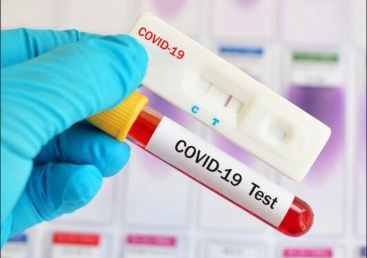 देश में कोरोना की दूसरी लहर के मंद पड़ने के साथ पाजिटिविटी दर में काफी कमी