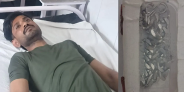 UP Police Action: बरेली पुलिस की अनोखी ‘रिकवरी’, डॉक्टर की सलाह और Medical Procedure से पेट से निकलवाई चोरी की चेन