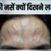 Forehead की उभरी नसों और तनाव के बीच गहरा संबंध: विशेषज्ञों की राय